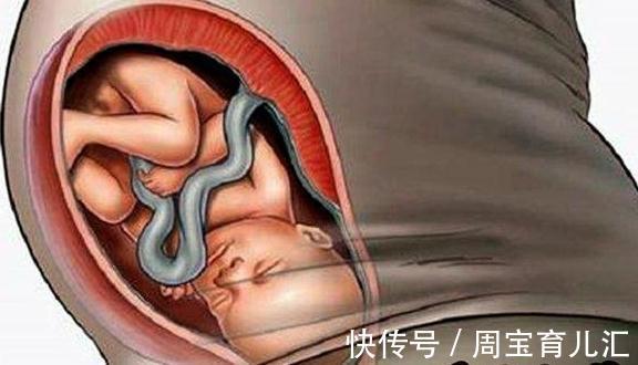分娩|胎儿入盆前后孕肚形状有啥差异?出现两变,说明快卸货了