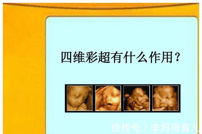 四维彩超|四维彩超不好过?医生:那是你没有提前了解注意事项