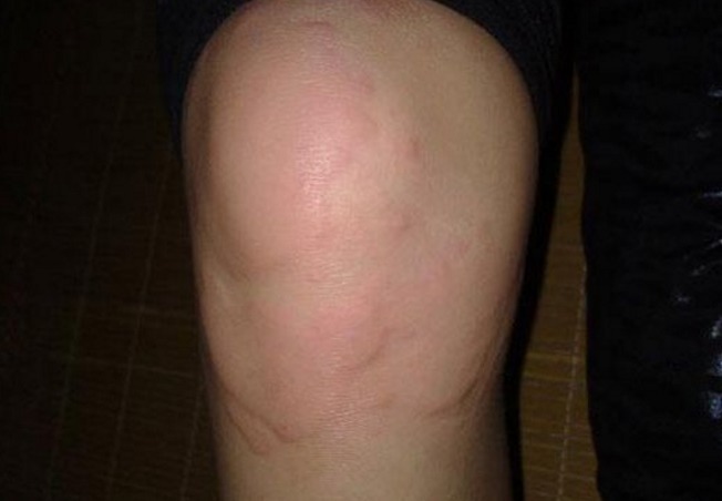 更上一层楼|清晨一个蛋,从头补到脚!但以下2类人吃鸡蛋,堪比服毒