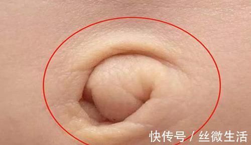 奥秘|怀孕后“肚脐凹”不易长妊娠纹,是真的吗?背后奥秘很多人不知道