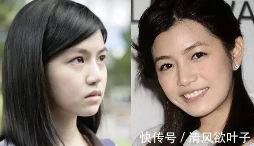 缺陷|这3种“生理缺陷”,很多人嫌弃,没想到却是长寿特征!