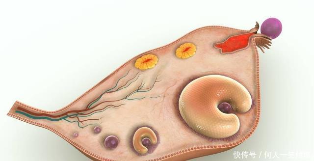 非遗传性|多囊卵巢是怎么引起的2个原因占大头，看完就明白了