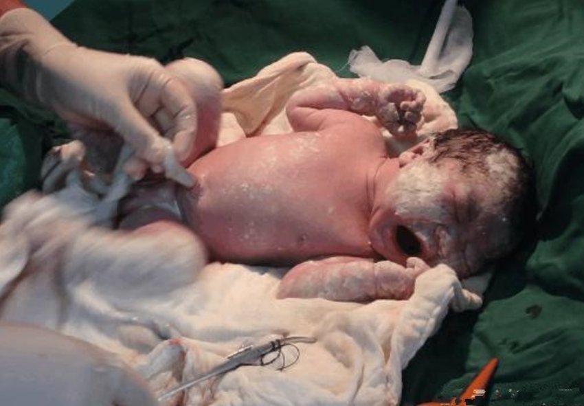 宝妈|产妇生下宝宝,看了一眼孩子大喊想要扔出去,令医生护士面面相觑