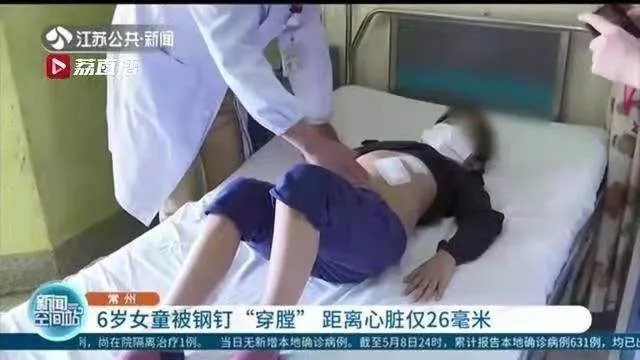 陶红|wenno:6岁男孩吞哨子,瞒了20年后肺部…不敢和父母说,是最危险的育儿信号