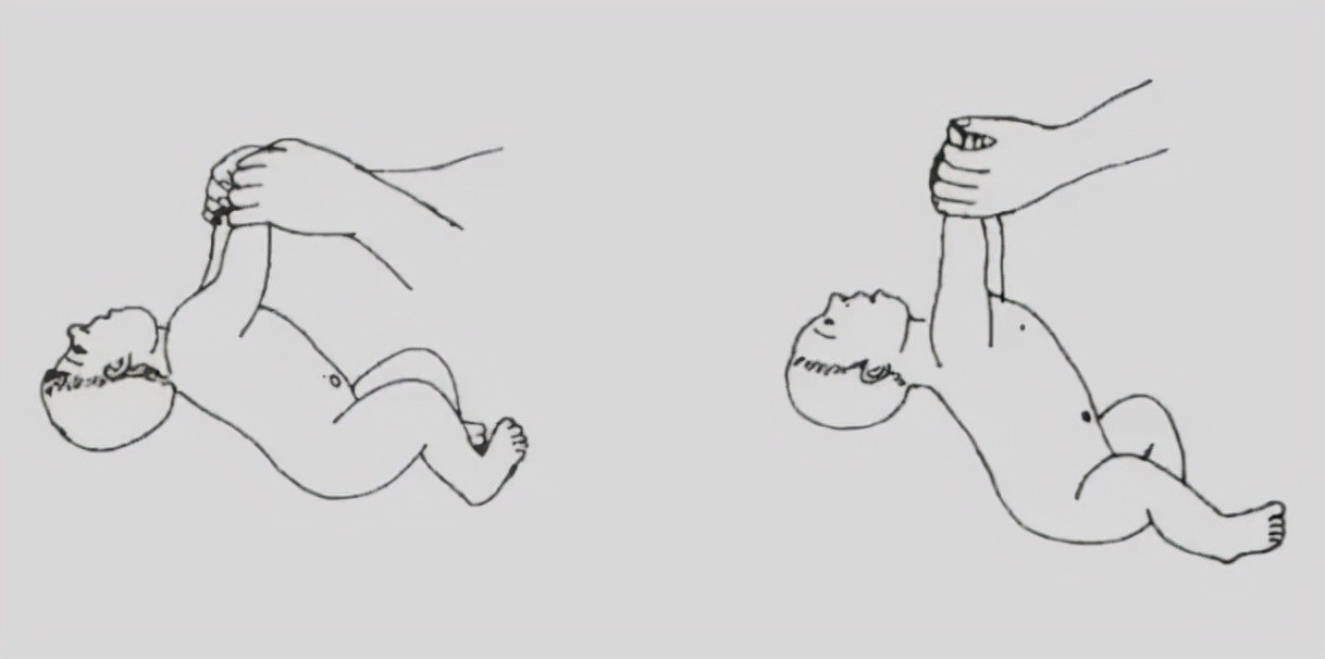 孩子|脑瘫孩子的治疗越早越好,怎么能早期发现孩子的异常呢?