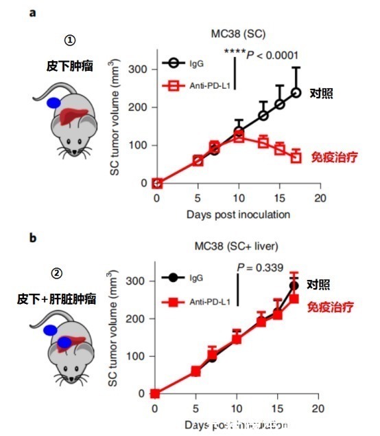 肝转移|让肺癌治疗失效的元凶竟然是它!逆转方法如此简单—抗癌管家