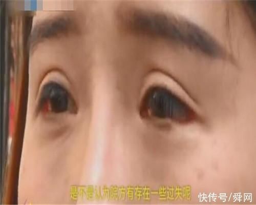 小到 女子整容失败遭破相,术后下眼睑少了一块,就像是腐烂的蚌壳肉……