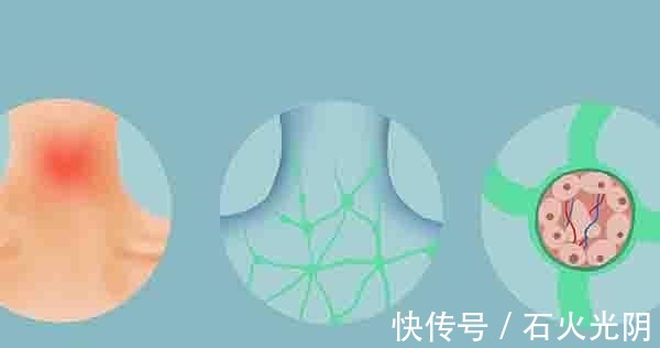 肿瘤|假如查出了癌症，就一定要切除吗？不用悲观，医生给出了2条建议