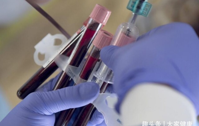 检查|血常规到底能不能检查出癌症?这3个指标有异常,要做详细检查!