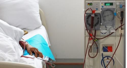 肾病|看尿量就能知道肾功能的好坏？教你“2招”防范尿毒症更有效