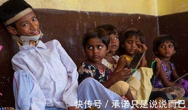 利瓦|男孩头部怪异,只能挂在胸前,手术7个月后的模样让人感动到哭!