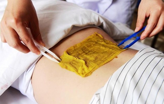 祛湿|夏季体内湿气重中医祛湿有妙招,送你5招祛湿很管用