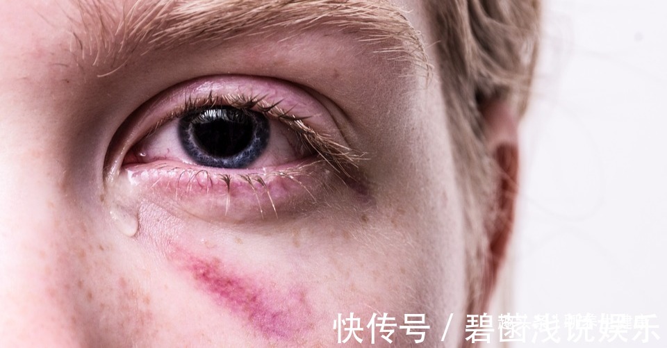 红苋菜|一两苋菜一两金!4种吃法解毒减脂、补钙益脑,胜过诸多大补药!