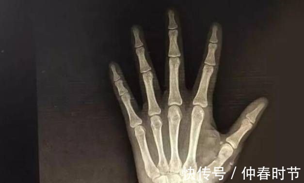 睡眠时间|女孩来月经开始身高就会停止了吗很多家长其实并不清楚,别忽视