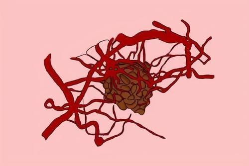 皮肤瘙痒|胰腺癌生存率低,善于隐藏,医生:若是发现3个症状,需提高警惕