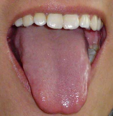 糖尿病|身体出现5个特征，提前恭喜，你很健康，易长寿，别再吓唬自己了