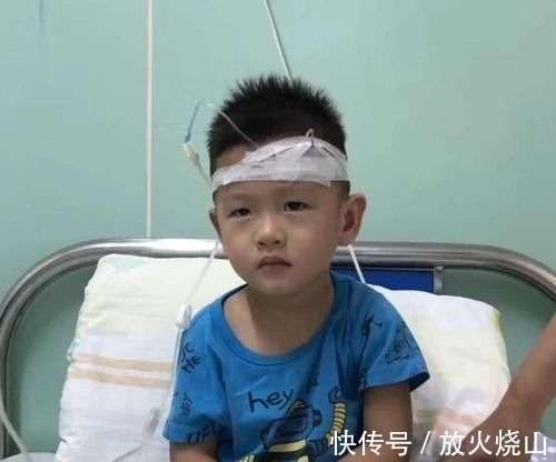 积食|爱积食的孩子易多病,建议多吃一果,不是苹果,袪积食养好脾