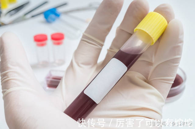 高血脂|高血脂“克星”大公开!坚持做三件事,血管干净,血脂乖乖听话!