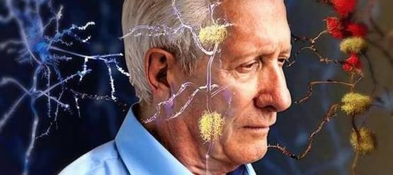  祸根|老年痴呆“祸根”终于暴露，专家提醒：4类易感人群榜上有名！