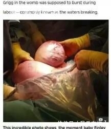 哪吒|医生从妈妈肚子里取出一个肉球!网友:这是哪吒啊