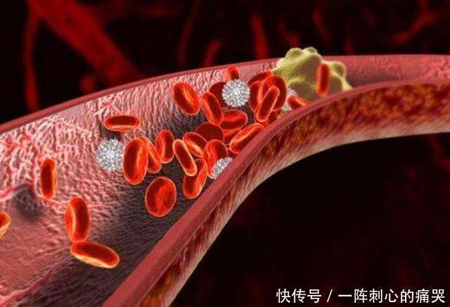 溶栓王|5种食物堪称“溶栓王”,血管淤堵的人可多吃,助你清血栓通血管