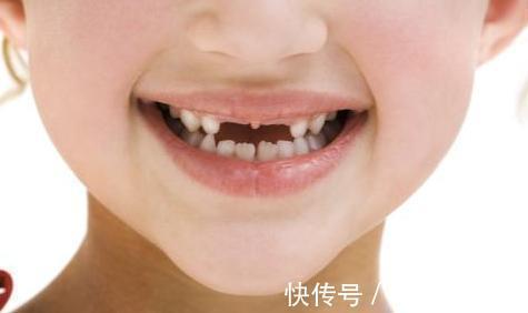 维生素宝宝3岁前,家长日常护理要做到“五要”,让孩子身心健康更聪明