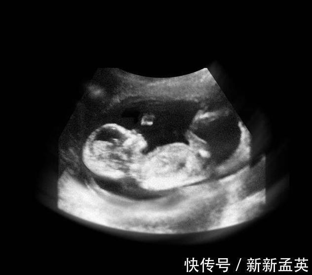 胚胎|胎儿从卵泡到性别形成,17张图片清晰诠释,男宝女宝看得很清楚