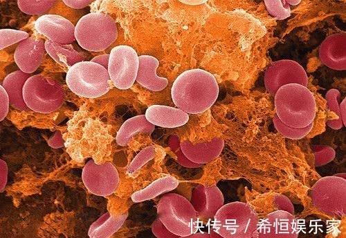 呼吸困难|血液稠不稠看嘴巴!若没出现3个信号,恭喜血管还很畅通!