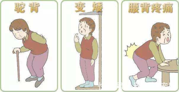 易骨折|更年期不能忽视的症状,三分之一女性因此患病!了解一下