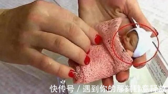 姑娘|14年前出生时不足1斤的“拇指姑娘”，现状如何网友惊人反转