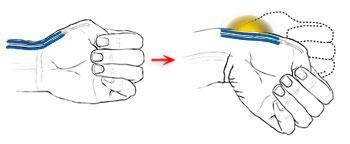 大拇指|医生患上“妈妈手”,竟自己给自己做手术,网友是个狠人,佩服