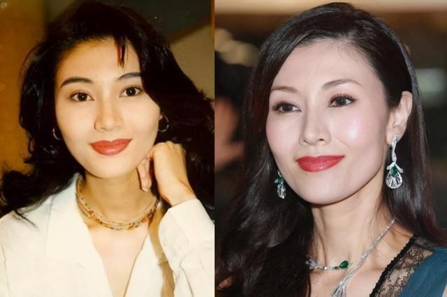 隆鼻|知名女星惊现“女巫鼻”天价隆鼻就能整出好鼻子