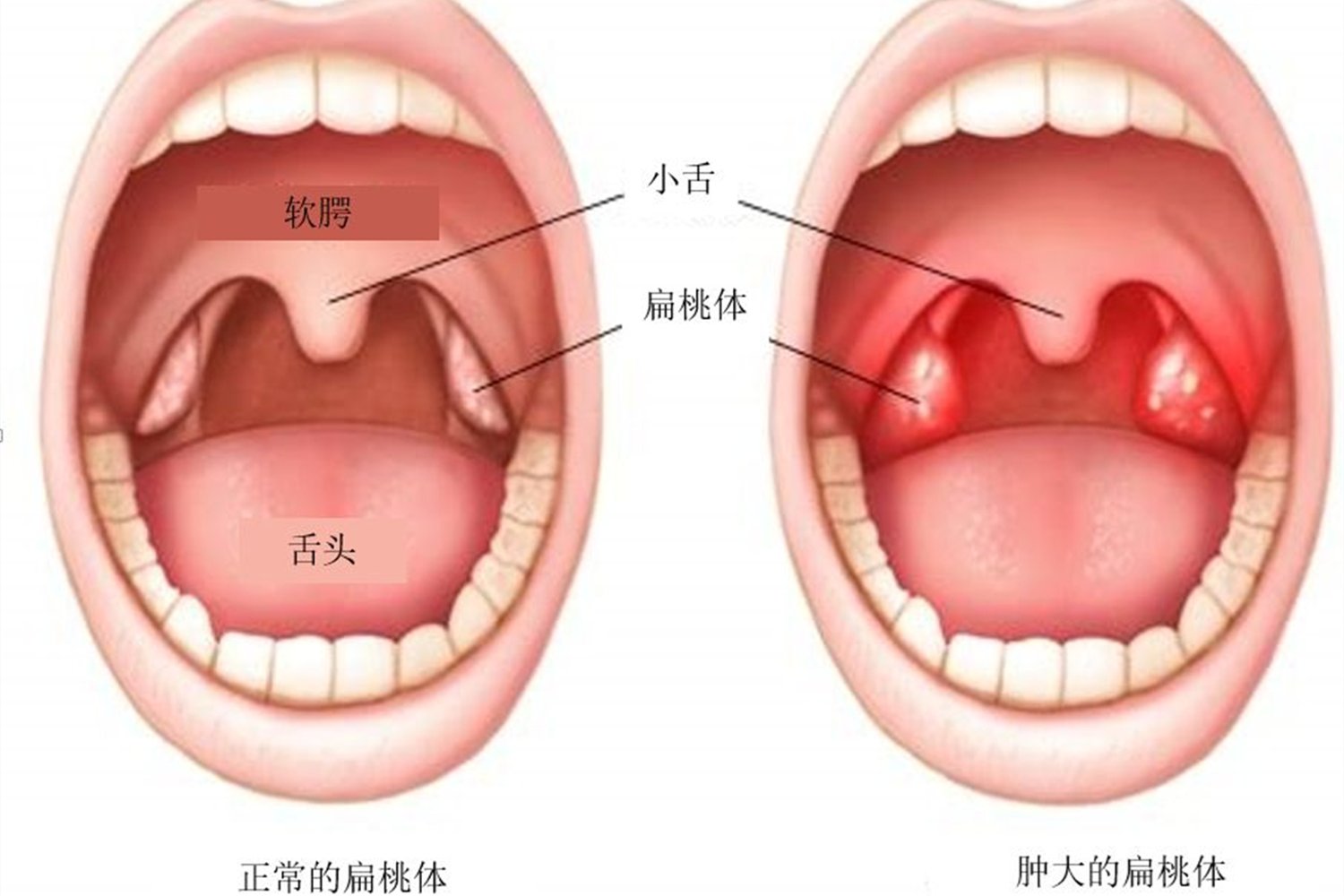 自查|这个不起眼的睡眠特征，会对娃的智力发育造成影响，宝妈快自查