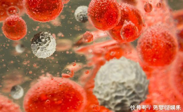 血脂升高后,这3种食物要忌口,若不注意,血管会“水泄不通”