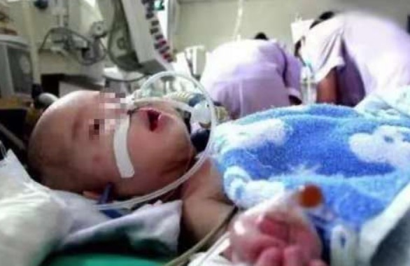 白糖|还把鸡蛋和此物一起喂孩子1岁小女孩不幸去世,因宝妈常做此饭