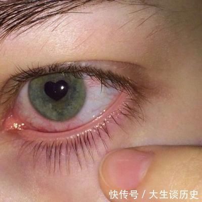 不良习惯|青春期“糟蹋”眼睛的3个行为，玩手机未上榜，它才是“始作俑者”