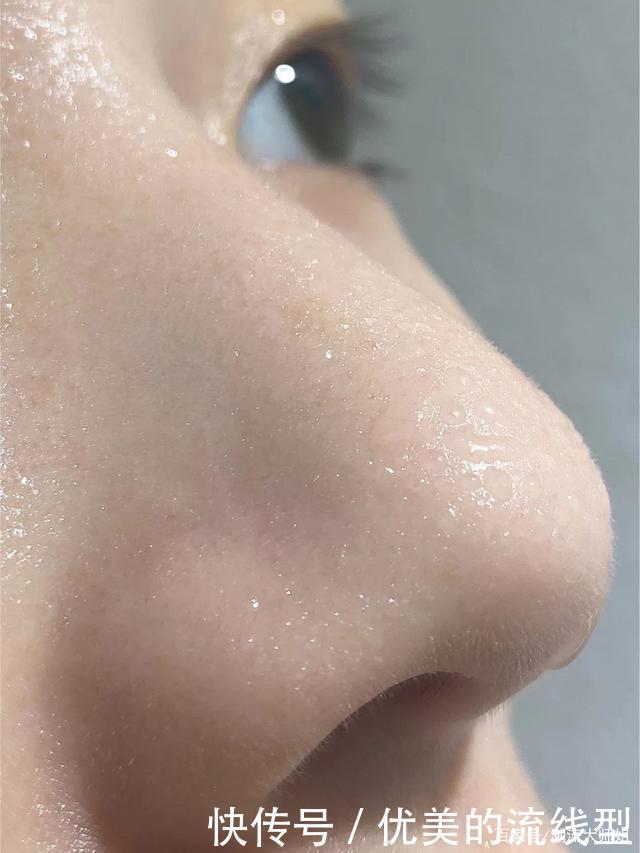 荷荷巴油|这才是去黑头的正确方式,安全有效不伤肤,无暇鸡蛋肌你也能拥有