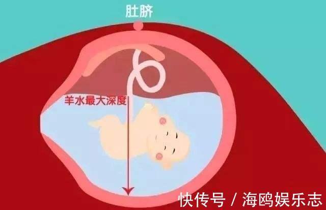 孕产妇保健手册|3类食物会降低羊水质量，影响宝宝发育，这些表现说明羊水好