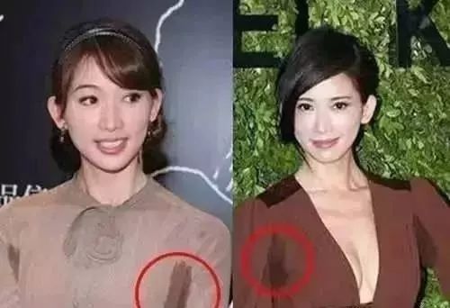 糖尿病患者|这个部位出汗,竟是中风前兆!(附最全出汗健康对照表)