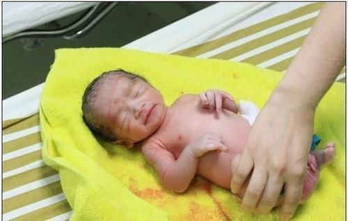 罗医生|经过了一夜的待产,终于要跟宝贝见面了,我的剖腹产记录