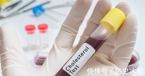 他汀类药物|高血脂没感觉就不用管?做到这2点,让你正确应对高血脂