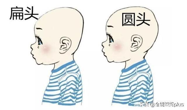 孩子|“妈求求你，别给我睡扁头了”扁头有多毁娃？3张对比图告诉你