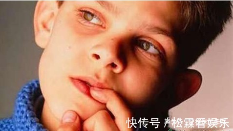 牙齿|会影响孩子牙齿发育和颜值的八大坏习惯，建议尽早戒掉！