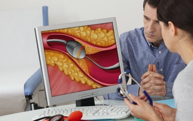 胆固醇|血脂升高,腿脚先知!腿脚出现4种“怪象”,提示你该降血脂了