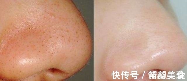 洗脸|“盐水”洗脸原来有这么多好处,不知道的人吃亏啦