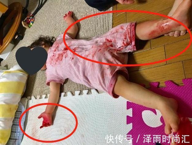 孩子|妈妈拿快递回家，眼前这幕让她情绪失控：4岁女儿躺在“血泊”中
