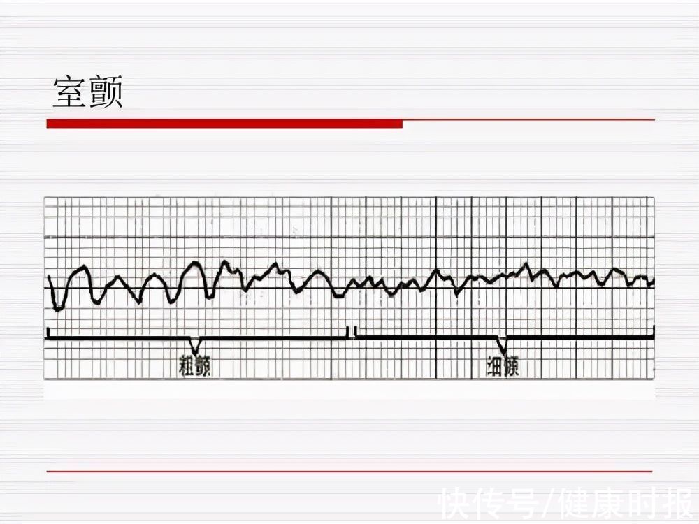 患者|谣言真的害人！只因做错了一件事，夫妻阴阳两隔