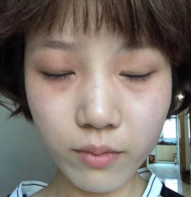 夏日|女生夏日护肤,比防晒更重要的是:晒后修复!这才是“变黑”原因