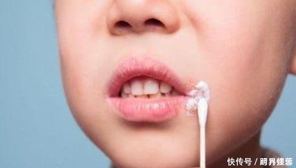 若嘴唇有这6个症状,说明身体出现了问题,看看