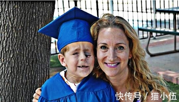 眼睛|小男孩出生时父母吓一跳,眼睛竟然长在脸上,长大后了不起!